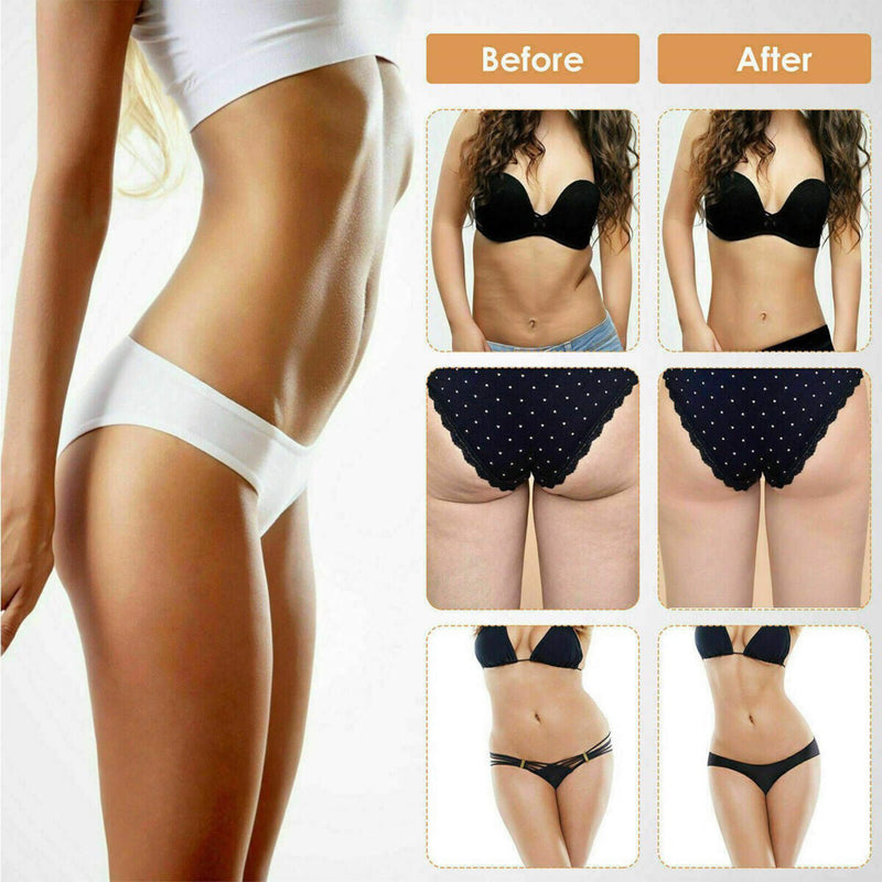 Professional Ultrasonic Cavitation RF Laser Lipo Machine -  Fat Reduction & Weight Loss (SAK95112) - Saksby Wholesale - Comparison View