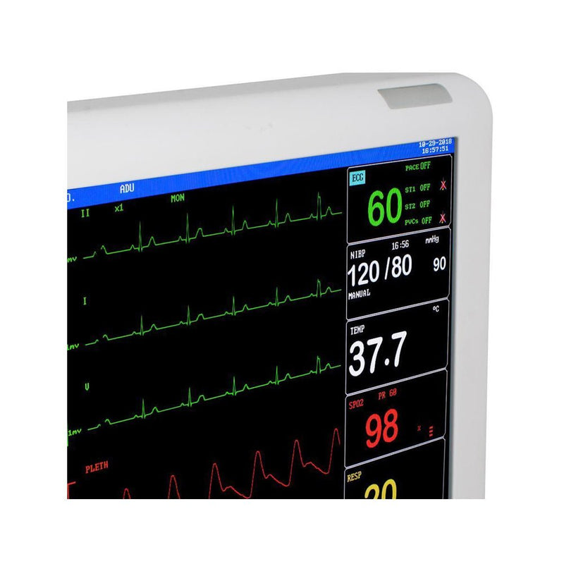 Portable ECG NIBP RESP Vital Sign Patient ICU Machine Monitor, 8" (93467253) - SAKSBY.com - Vital Signs Monitors - SAKSBY.com